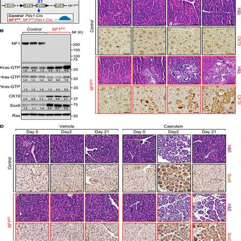 Nf Ablation Leads To Adm A Schematic Representation Of Genetically