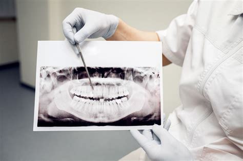 Dentistas En Priego De C Rdoba La Importancia De La Higiene Bucal En