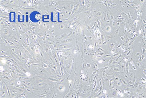 Hulec 5a人肺微血管内皮细胞 上海葵赛生物科技有限公司