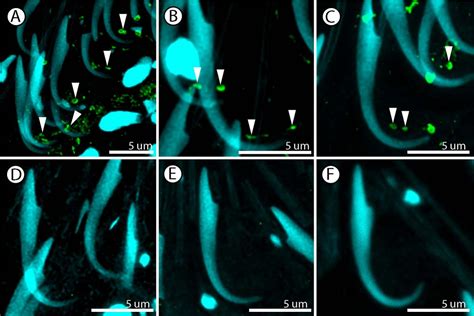 Orp Knockdown Delays The Maturation Of Junction Related Endocytic