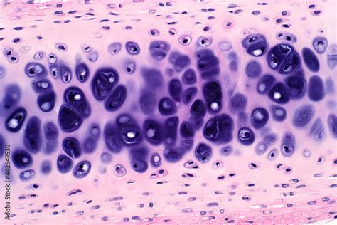 Cross Section Human Cartilage Bone Under Light Microscope View For