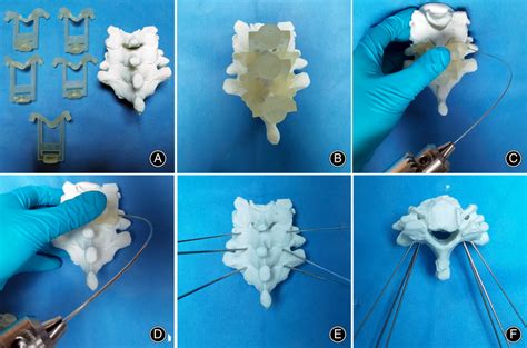 Surgical Simulation Based On The 3D Printed Models A The 3Dprinted