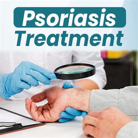 Natural Treatment For Skin And Scalp Psoriasis Achieving Permanent Relief By Bharat