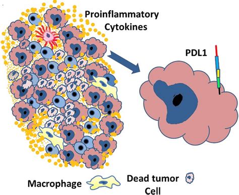 Schematic Drawing Of A Tumor With Pd L1 Staining There Are 37 Tumor