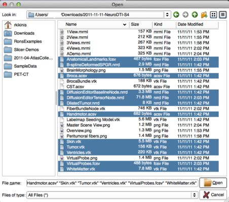 documentationnightlyslicerapplicationloadingdata slicer wiki