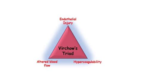 Hemodynamic disorders Archives - Pathology Made Simple