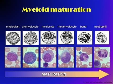 Myelocyte Vs Promyelocyte - - Image Search Results | Laboratory science ...