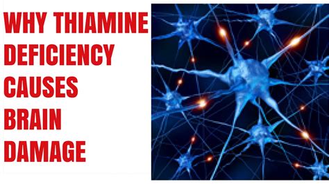 Thiamine Deficiency Causing Brain Damage Youtube