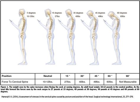 Correcting Forward Head Posture With Expert Tips Chiropractic Scientists 915 850 0900