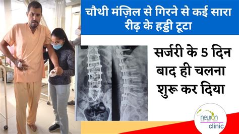 Complex Spine Surgery By Dr Vikas Bhardwaj I Dr Neha Pathak Youtube