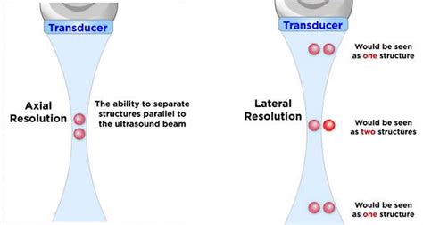 Basics Of Ultrasound Physics For Pocus Show Me The Pocus