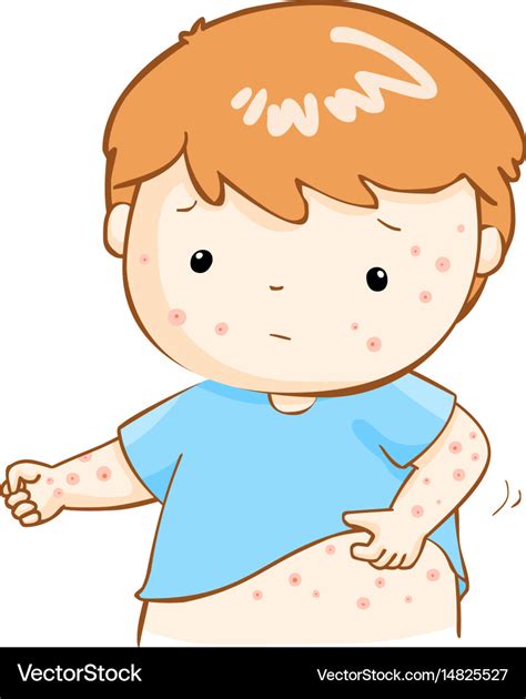 Boy Scratching Itching Rash On His Body Royalty Free Vector