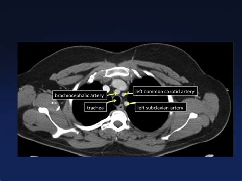 Cross Sectional Anatomy Of The Body Mdct Atlas Ct Scanning