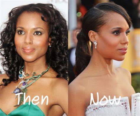 Kerry Washington Plastic Surgery Has No Conclusive Evidences