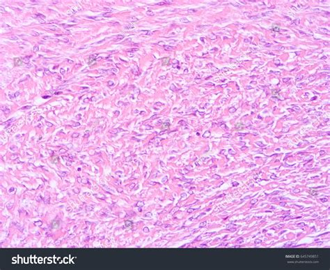 Histology Human Tissue Show Fibrous Cartilage Stock Photo (Edit Now ...