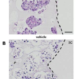 Figure S4 Cell Line Model Of Collective Invasion HCC1954 Cell