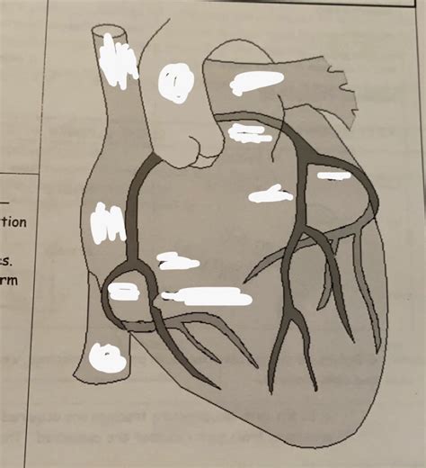 Coronary Arteries Diagram Quizlet