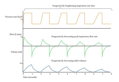 Inspiratory Pause Ie Ratio And Inspiratory Rise Time Deranged Physiology