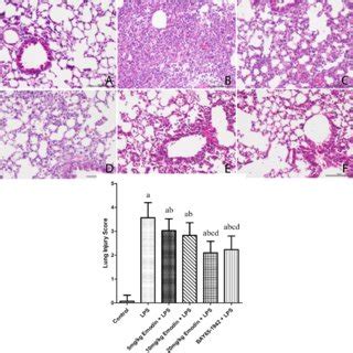 Emodin Pretreatment Alleviated Lps Induced Lung Injuries In Ards Mice