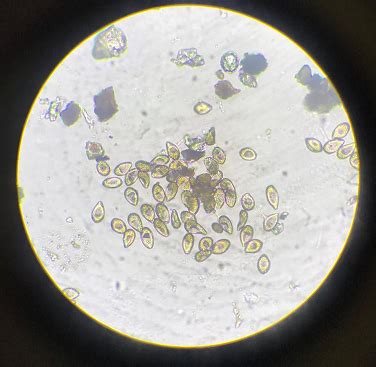 Ferrugem Asi Tica Da Soja Como Identificar O Esporo Da Ferrugem Tentos