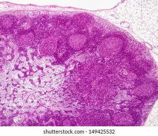 Lymph Node Microscope Slide