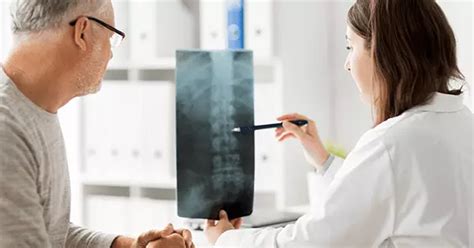 Osteoporoz Kemik Erimesi Nedir Osteoporoz Belirtileri Ve Tedavisi