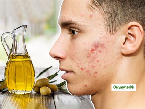 Benefits Of Olive Oil For Skin Whitening Best Sale Laseb Fae Ufmg Br