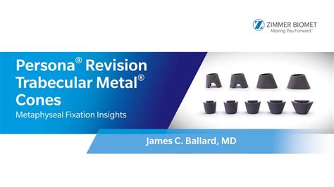 Persona® Revision Trabecular Metal® Cones Metaphyseal Fixation Insights