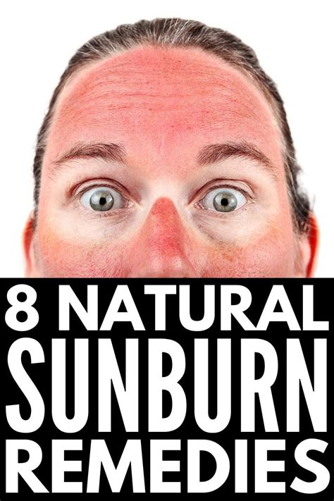 Sunburn Skin Artofit