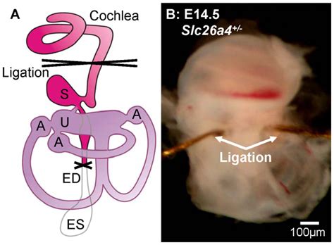 Endolymphatic Sac