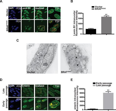 Figure From Autophagy Mediated Degradation Of Nuclear Envelope