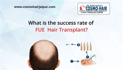 What Is The Success Rate Of Fue Hair Transplant Cosmo Hair