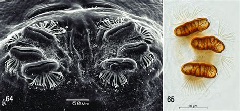 , 65. Scanning electron photomicrograph and optical photomicrograph of ... 