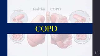 Pharmacotherapy Of Asthma And Chronic Obstructive Pulmonary Disease