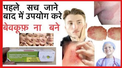 Fungal Infection Daad Khaj Khujli Ki Dawa Skin Infection Treatment