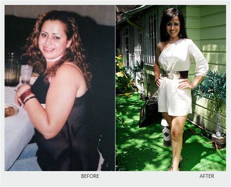 SculptorBody TM - Extreme Makeover Before & After