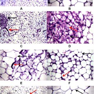 Effects Of DG On HFD Induced Histopathological Changes In Adipose