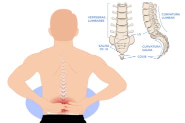 Qu Es La Lumbalgia Mec Nica Quiropr Ctico Barcelona