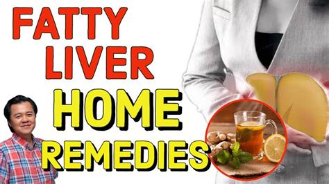 Fatty Liver Home Remedies By Doctor Willie Ong Internist And Cardiologist Youtube