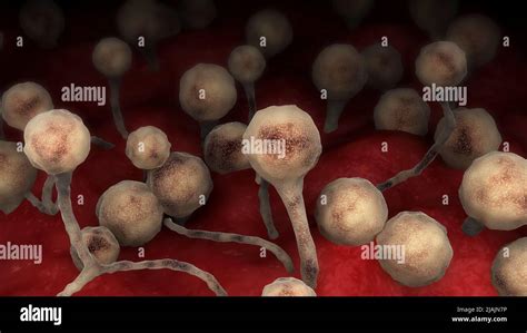 Conceptual Biomedical Illustration Of The Fungal Infection Mucormycosis