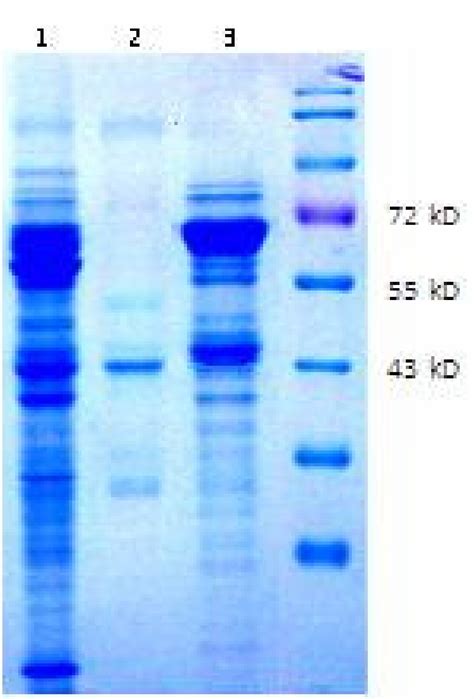 Denaturing Polyacrylamide Gel Electrophoresis Page Revealed By Download Scientific Diagram