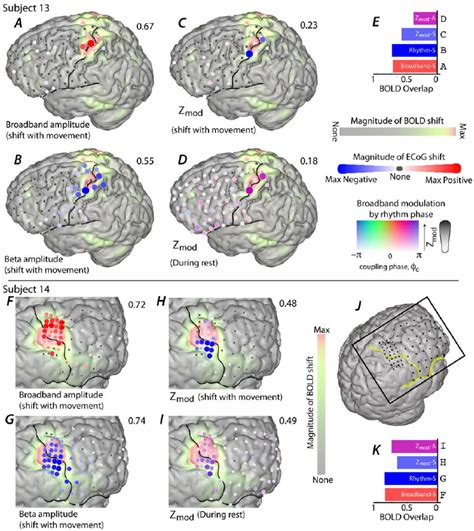 The Relationship Between Fmri Bold Signal Change And Ecog Spectral