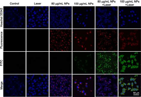 Frontiers Polydopamine Encapsulated New Indocyanine Green Theranostic