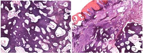 Photomicrograph Of H And E Stained Section Showed Well Circumscribed