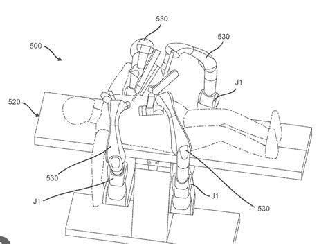 Ottava Surgical Robot First Early Review And Sadly Concerns