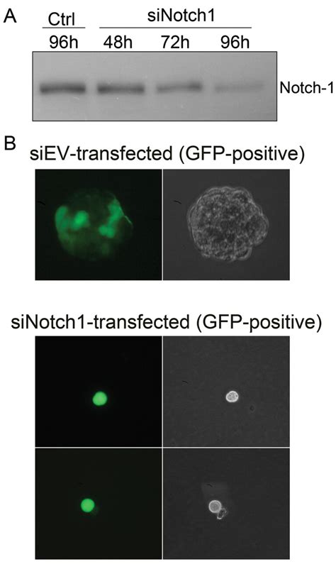 Figure 9 Inhibition Of Notch Signaling Reduces The Stem Like