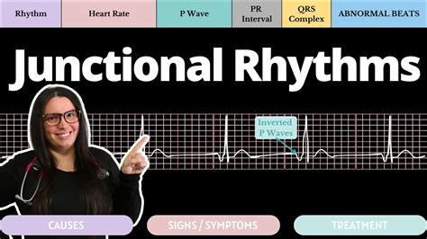 Junctional Rhythms On An Ekg With Qs Circulatory System And Disease Nclex Rn Nurse Cheung