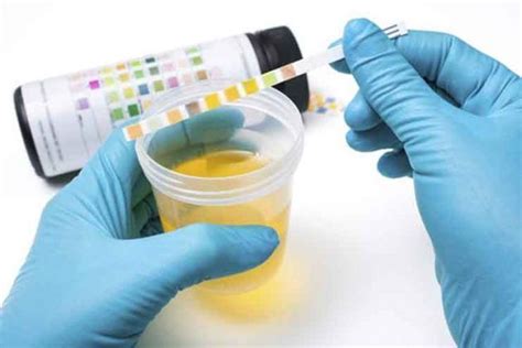 What Does Cloudy Urine Mean Cloudy Urine Causes And Treatment