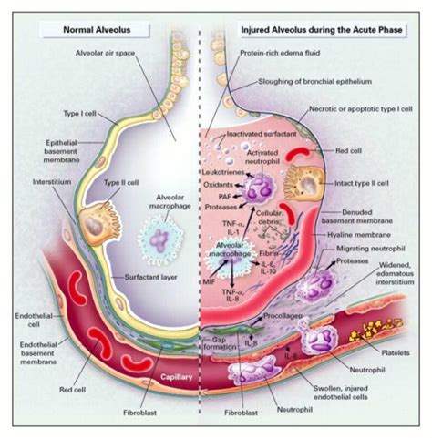 The Biology And Immunology Of Covid 19 Susceptibility