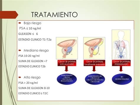 Conozca Todo Sobre El Cancer De Prostata Causas Sintomas Diagnostico Y